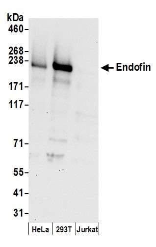 ZFYVE16 Antibody (aa825-875)