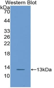 BRAK / CXCL14 Antibody (aa23-99, FITC)