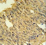 Polyclonal Rabbit anti-Human SLC25A28 Antibody (aa36-64, IHC, WB)