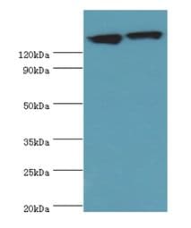Polyclonal Rabbit anti-Human DCTN1 / Dynactin 1 Antibody (aa1084-1278, IHC, WB)