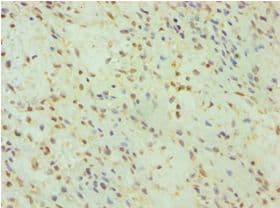 Polyclonal Rabbit anti-Human DFNA5 Antibody (aa1-260, IHC, WB)