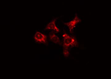 CCT6A Antibody