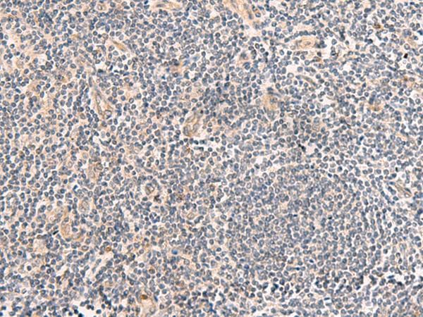 TEAD3 Antibody