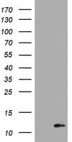 S100B / S100 Beta Antibody (clone OTI2H7, Carrier-free)