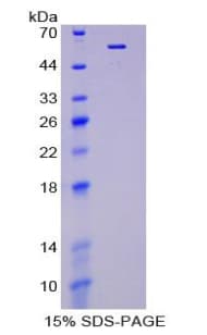 Mouse UMOD / Uromodulin Protein (Recombinant His-GST)