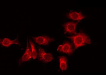 TMEM101 Antibody