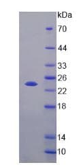 Mouse FGF21 Protein (Recombinant His, N-Terminal)