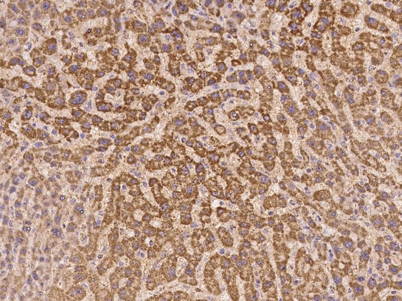 Polyclonal Rabbit anti-Human C8orf86 Antibody (IHC)