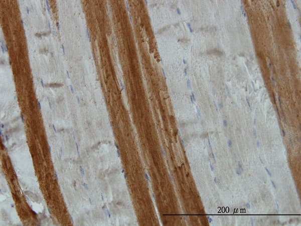 Monoclonal Mouse anti-Human TOM1 Antibody (clone 5A3, IHC, WB)