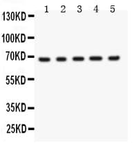MEN1 / Menin Antibody (aa301-615)