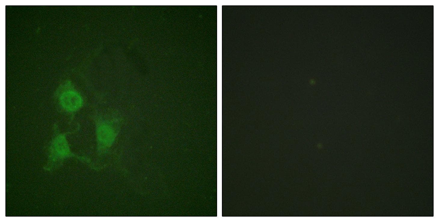 Polyclonal Rabbit anti-Human PRKAR2A/B Antibody (phospho-Thr197, IHC, IF, WB)