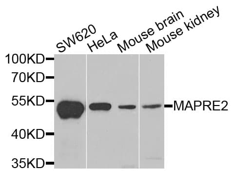 MAPRE2 / EB2 Antibody