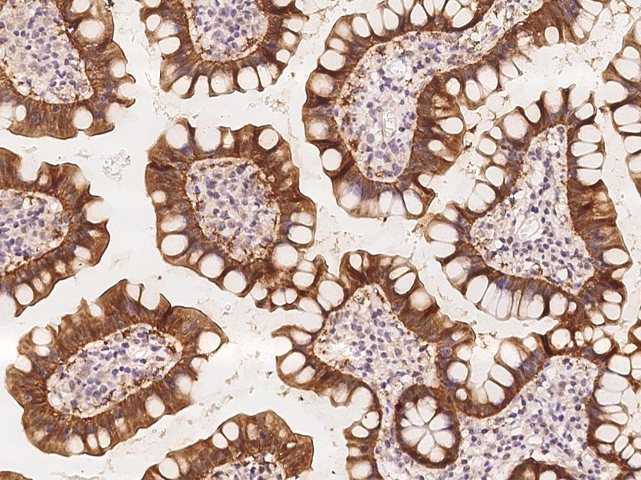 Polyclonal Rabbit anti-Human ATAD4 Antibody (IHC)