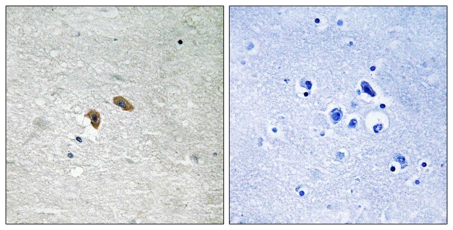 Polyclonal Rabbit anti-Human RAF1 / RAF Antibody (phospho-Thr269, IHC)