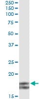 MYL2 Antibody (clone 3B9-B4)
