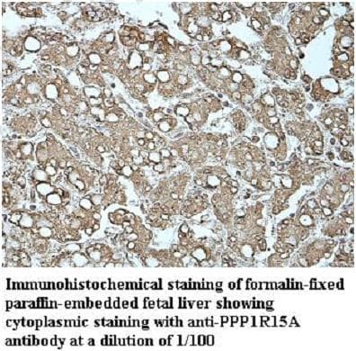 PPP1R15A / GADD34 Antibody (aa115-211)