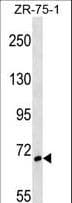 SH3BP1 Antibody (aa419-446)