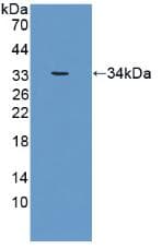 CRAT Antibody (aa363-626, PE)