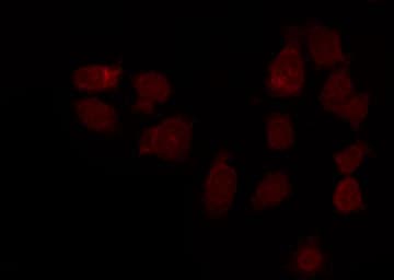 FOXO1 / FKHR Antibody