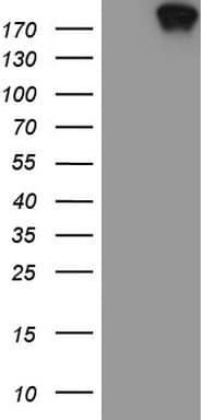 Monoclonal Mouse anti-Human TOP2A / Topoisomerase II Alpha Antibody (clone OTI2D12, aa1100-1531, IHC, WB)