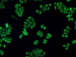 IHC-plus™ CRYAB / Alpha B Crystallin Antibody (clone 4A6)