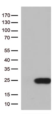TSEN15 Antibody (clone OTI5A3)