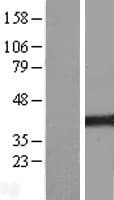 Human UBR7 / C14orf130 Protein (Over-Expression Lysate Myc-DDK (Flag))