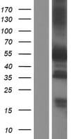 PXN / Paxillin Protein (Over-Expression Lysate Myc-DDK (Flag))