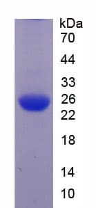 Human JAG1 / Jagged 1 Protein (Recombinant His)