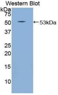 SEMA4B / Semaphorin 4B Antibody (aa644-832, HRP)