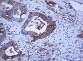 KRT5 / CK5 / Cytokeratin 5 Antibody (clone OTI6F8)