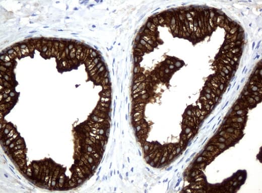 Monoclonal Mouse anti-Human KRT18 / CK18 / Cytokeratin 18 Antibody (clone UMAB50, Carrier-free, aa69-372, IHC, IF, WB)