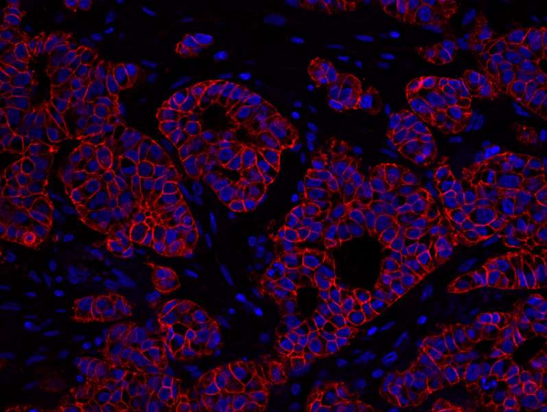 Polyclonal Rabbit anti-Human ERBB2 / HER2 Antibody (aa1200-C-term, IHC, IF)