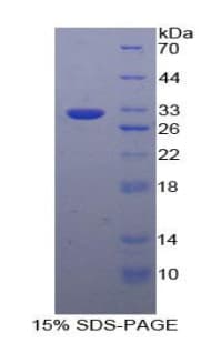 Human GPBB / PYGB Protein (Recombinant His-T7)