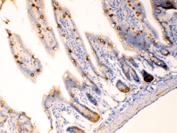 Polyclonal Rabbit anti-Human AGR2 Antibody (IHC, WB)