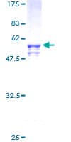 Human SOX15 Protein (Recombinant GST)