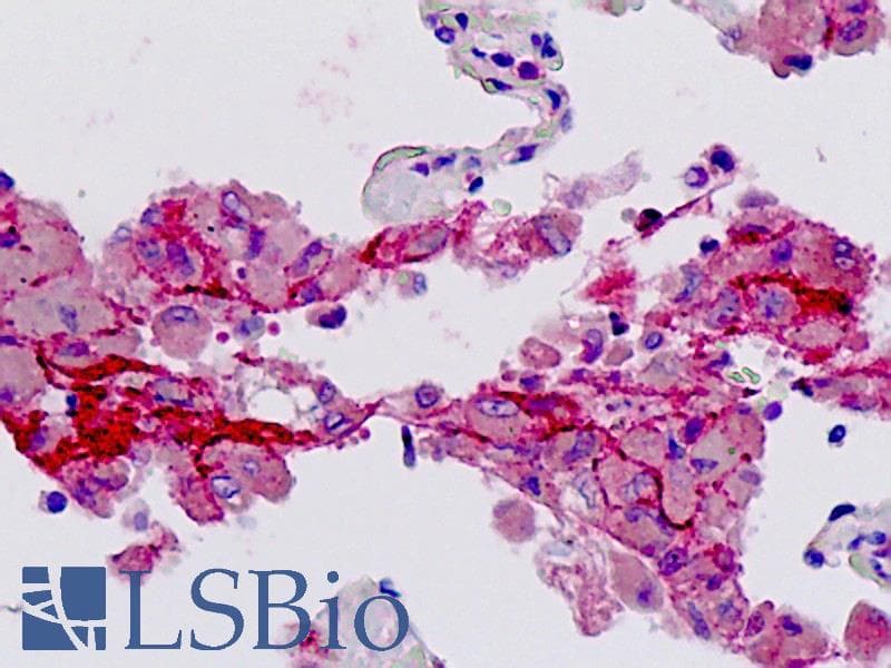 IHC-plus™ F2R / Thrombin Receptor / PAR1 Antibody (aa23-72)