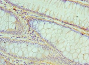 CBFB Antibody (aa1-182)