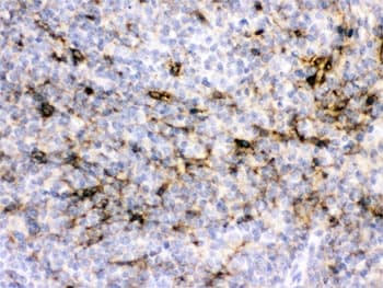 CRYAA / Alpha A Crystallin Antibody
