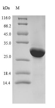 Human LPPR2 Protein (Recombinant 6His-B2M, N-terminus)