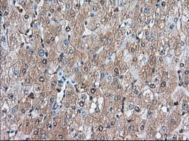 BDH2 Antibody (clone OTI4G4)