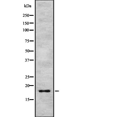 Polyclonal Rabbit anti-Human IL17F Antibody (IHC, IF, WB)