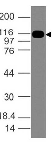 SMO / Smoothened Antibody