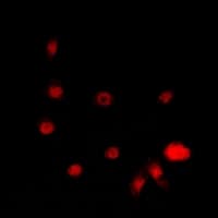 STK19 Antibody