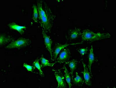 Polyclonal Rabbit anti-Human WTAP Antibody (IHC, IF, WB)
