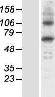 Human HGD Protein (Over-Expression Lysate Myc-DDK (Flag))