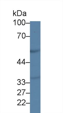 TNFRSF1A / TNFR1 Antibody (aa239-433, APC)
