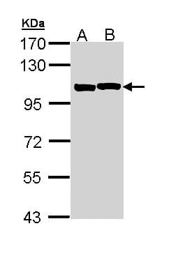 IHC-plus™ ACTN2 Antibody