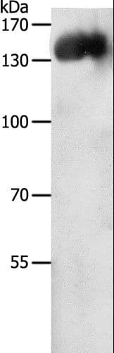 Polyclonal Rabbit anti-Human PECAM-1 / CD31 Antibody (IHC, WB)