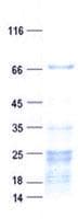 Human L3MBTL4 Protein (Recombinant His, N-Terminal)